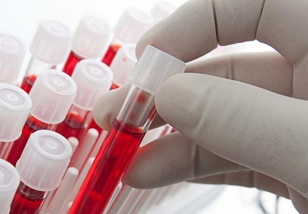 test krvi nakon pijenja alkohola